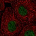 RPA70 Polyclonal Antibody