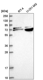 RPA70 Antibody in Western Blot (WB)