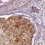 ERV3 Polyclonal Antibody