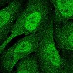 POLD1 Polyclonal Antibody