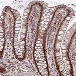 POLD1 Antibody in Immunohistochemistry (Paraffin) (IHC (P))