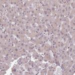 POLD1 Antibody in Immunohistochemistry (Paraffin) (IHC (P))