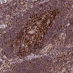POLD1 Antibody in Immunohistochemistry (Paraffin) (IHC (P))