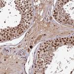 POLD1 Antibody in Immunohistochemistry (Paraffin) (IHC (P))