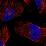 CDK5RAP2 Polyclonal Antibody