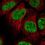 EVI1 Polyclonal Antibody