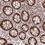 EVI1 Antibody in Immunohistochemistry (Paraffin) (IHC (P))