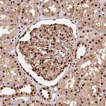 EVI1 Antibody in Immunohistochemistry (Paraffin) (IHC (P))