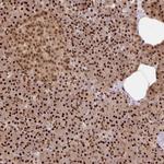EVI1 Antibody in Immunohistochemistry (Paraffin) (IHC (P))