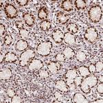 EVI1 Antibody in Immunohistochemistry (Paraffin) (IHC (P))