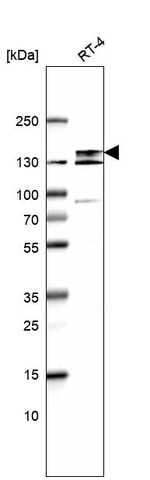 EVI1 Antibody in Western Blot (WB)