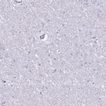 CD177 Polyclonal Antibody