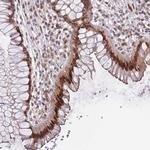 C1orf145 Antibody in Immunohistochemistry (Paraffin) (IHC (P))