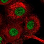 GTF2H1 Polyclonal Antibody