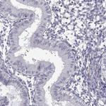 SPINT4 Polyclonal Antibody