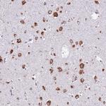 VARS Antibody in Immunohistochemistry (Paraffin) (IHC (P))