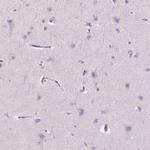CES1 Antibody in Immunohistochemistry (Paraffin) (IHC (P))