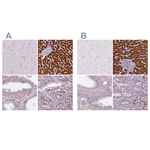 CES1 Antibody in Immunohistochemistry (Paraffin) (IHC (P))