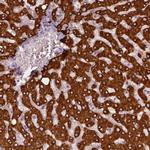 CES1 Antibody in Immunohistochemistry (Paraffin) (IHC (P))
