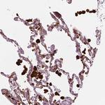 CES1 Antibody in Immunohistochemistry (Paraffin) (IHC (P))