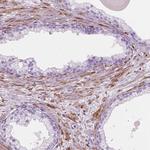 CES1 Antibody in Immunohistochemistry (Paraffin) (IHC (P))