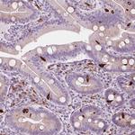 CES1 Antibody in Immunohistochemistry (Paraffin) (IHC (P))