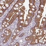 PTPN3 Polyclonal Antibody