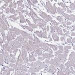 MYBPC2 Polyclonal Antibody