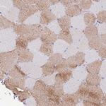 MYBPC2 Antibody in Immunohistochemistry (Paraffin) (IHC (P))
