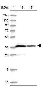 PP1 alpha Antibody in Western Blot (WB)