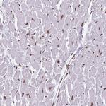 KPNA3 Antibody in Immunohistochemistry (Paraffin) (IHC (P))