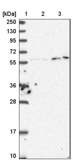 KPNA3 Antibody in Western Blot (WB)