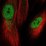 KRBOX1 Polyclonal Antibody