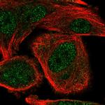 COMMD5 Polyclonal Antibody