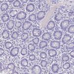 Chymotrypsin Antibody in Immunohistochemistry (Paraffin) (IHC (P))
