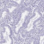 Chymotrypsin Antibody in Immunohistochemistry (Paraffin) (IHC (P))
