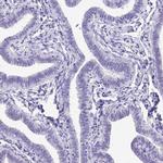 Chymotrypsin Antibody in Immunohistochemistry (Paraffin) (IHC (P))