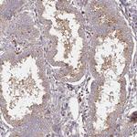 IDUA Antibody in Immunohistochemistry (Paraffin) (IHC (P))