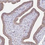 IDUA Polyclonal Antibody