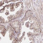 IDUA Antibody in Immunohistochemistry (Paraffin) (IHC (P))