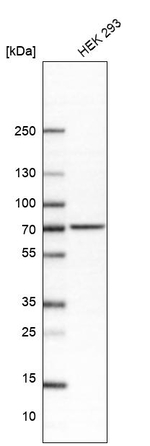 IDUA Antibody in Western Blot (WB)