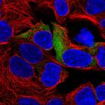 RPS3A Polyclonal Antibody