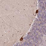 RPS3A Antibody in Immunohistochemistry (Paraffin) (IHC (P))