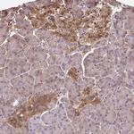 HIP Antibody in Immunohistochemistry (Paraffin) (IHC (P))
