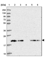 TMP21 Antibody in Western Blot (WB)