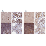 LAP1 Polyclonal Antibody