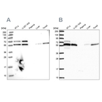 LAP1 Antibody in Western Blot (WB)