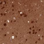Calcineurin B Antibody in Immunohistochemistry (Paraffin) (IHC (P))