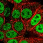 NUP50 Polyclonal Antibody