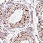 NUP50 Antibody in Immunohistochemistry (Paraffin) (IHC (P))